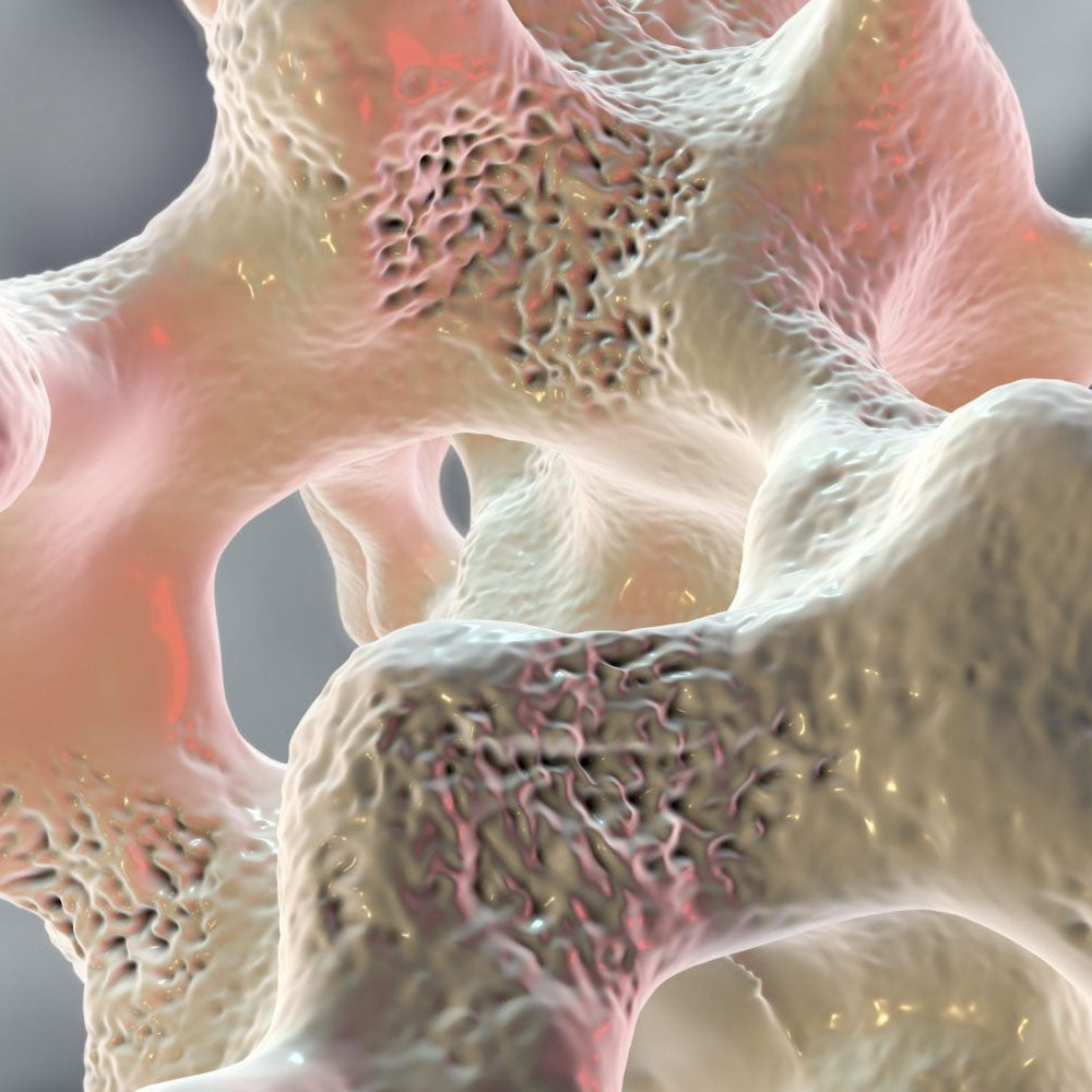 Osteoporosis & HTMA